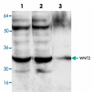 PAB9583 - WNT2