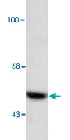 PAB9598 - AADC / DDC