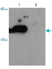 PAB9599 - PARK2 / Parkin