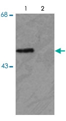 PAB9602 - PARK2 / Parkin