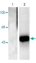 PAB9603 - ELK1