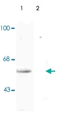 PAB9604 - TP53 / p53