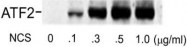 PAB9605 - ATF2