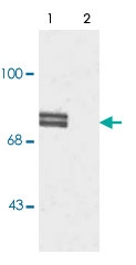 PAB9606 - ALOX5 / LOG5