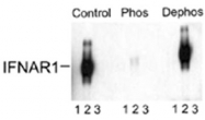 PAB9607 - IFNAR1