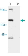 PAB9613 - TAO kinase 2 (TAOK2)