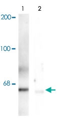 PAB9614 - PLK1