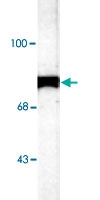 PAB9620 - NSF