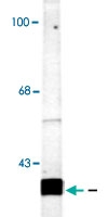PAB9622 - SNAP25
