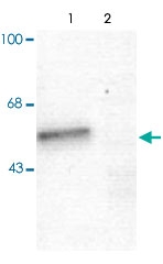 PAB9624 - GABRA1