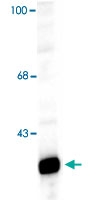 PAB9626 - DARPP32