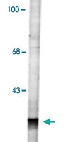PAB9627 - RAB3
