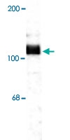PAB9629 - Amyloid beta A4 protein / APP