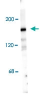 PAB9635 - NMDA Receptor 2A