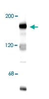 PAB9636 - NMDAR2B