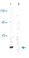 PAB9640 - Alpha-Synuclein / SNCA