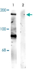 PAB9641 - NMDAR2B