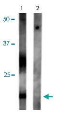 PAB9646 - Aquaporin-2 / AQP2