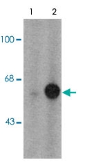 PAB9649 - Tyrosine 3-monooxygenase (TH)
