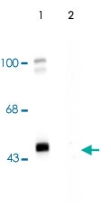PAB9651 - GABRG2
