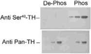 PAB9653 - Tyrosine 3-monooxygenase (TH)