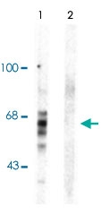 PAB9655 - MAPT / TAU