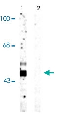 PAB9663 - GSK3 beta