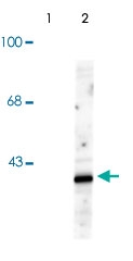 PAB9665 - MAP kinase p38 alpha / MAPK14