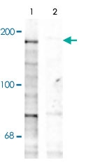 PAB9671 - NMDAR2B