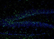 PAB9672 - NMDAR2B