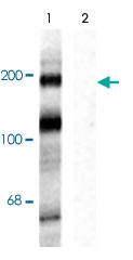 PAB9673 - NMDAR2B