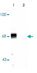 PAB9676 - PAK2