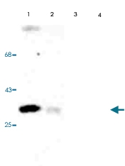 PAB9677 - CDK1