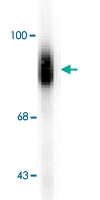 PAB9692 - Dopamine beta-hydroxylase