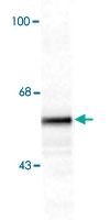 PAB9696 - Tyrosine 3-monooxygenase (TH)