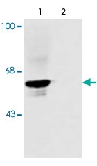 PAB9701 - Glycine receptor alpha-1
