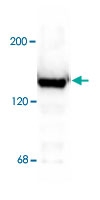 PAB9705 - NMDA Receptor 2C
