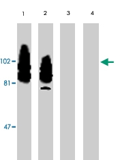 PAB9716 - CD156b / ADAM17