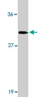 PAB9721 - TOLLIP