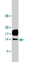 PAB9742 - CSAG2