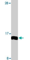 PAB9745 - UBE2N / BLU