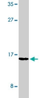PAB9746 - UBE2V1