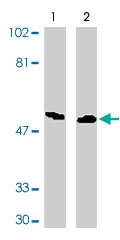 PAB9749 - DAPK3 / ZIPK