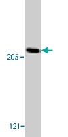 PAB9752 - Acinus / ACIN1