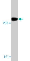 PAB9754 - Acinus / ACIN1