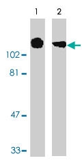 PAB9762 - Amyloid beta A4 protein / APP