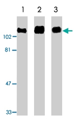 PAB9763 - Amyloid beta A4 protein / APP