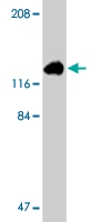 PAB9764 - APAF1