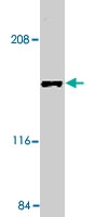 PAB9769 - MEKK5 / ASK1