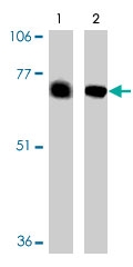 PAB9773 - BACE2